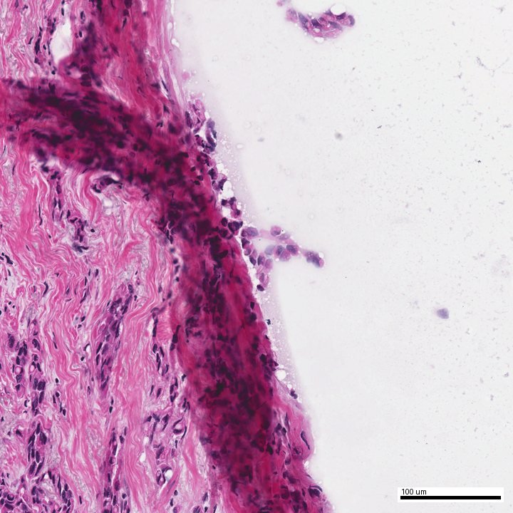 H&E tissue field from a de-identified demonstration report