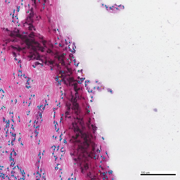 Model-generated nuclei overlay on the same field