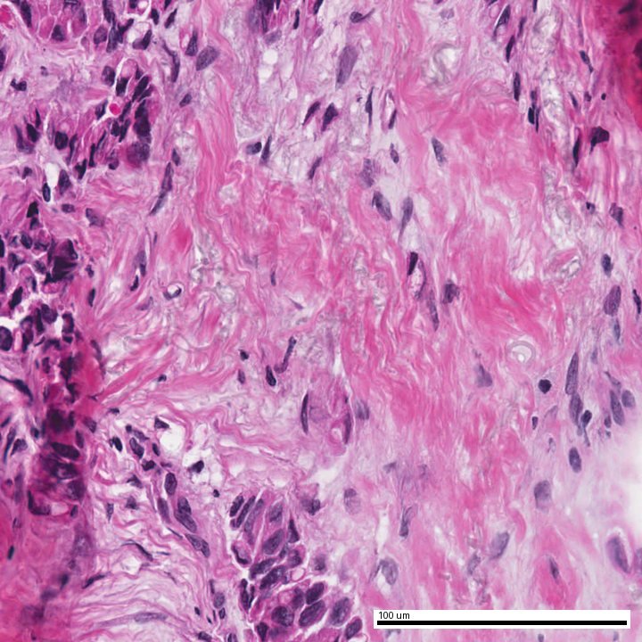 H&E field from a de-identified demonstration case